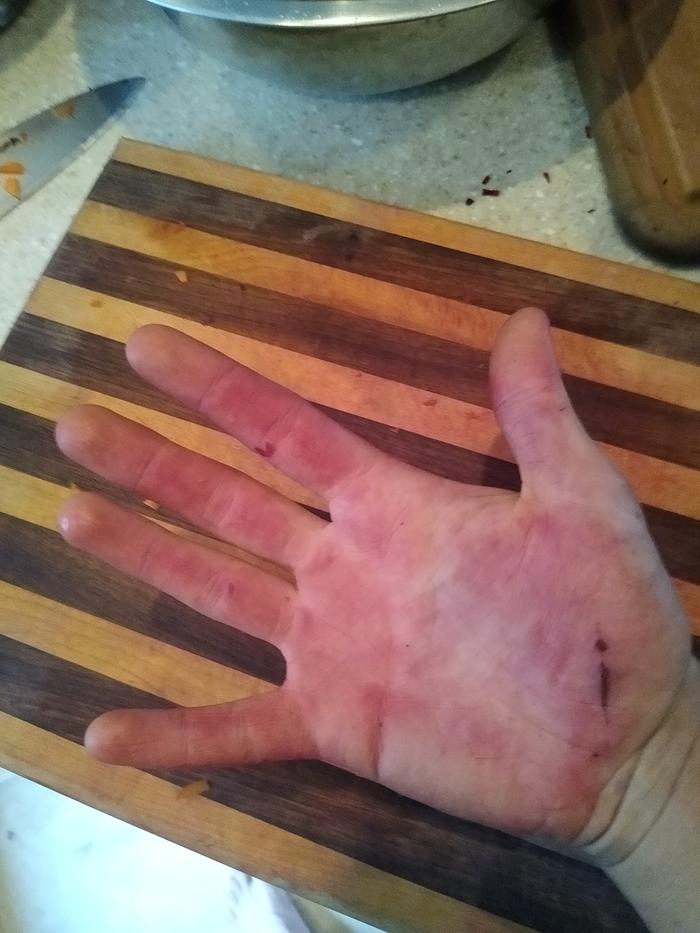 Stained my hand red chopping beats for dinner