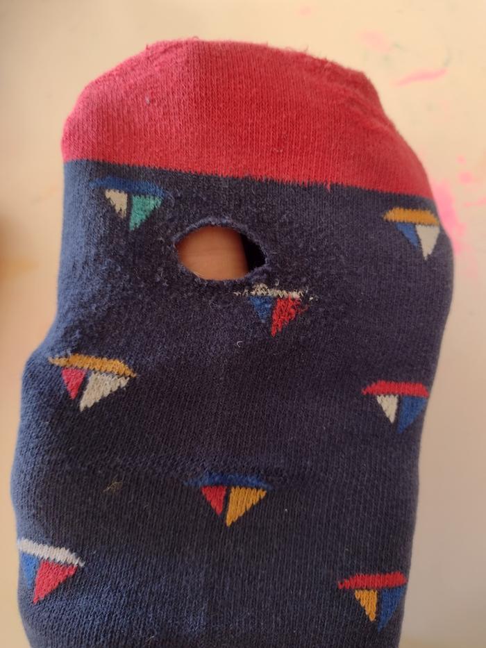 Hole in sock