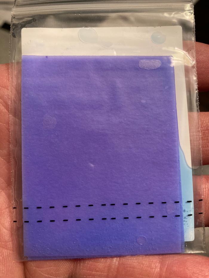 Test results. No bacteria.