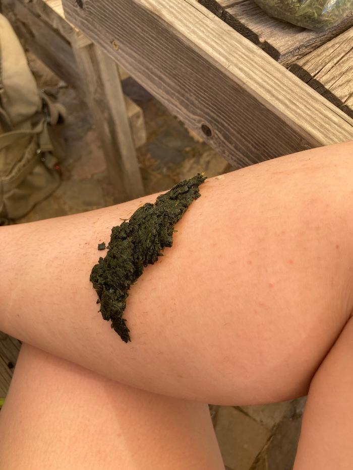 Comfrey poultice applied to my leg