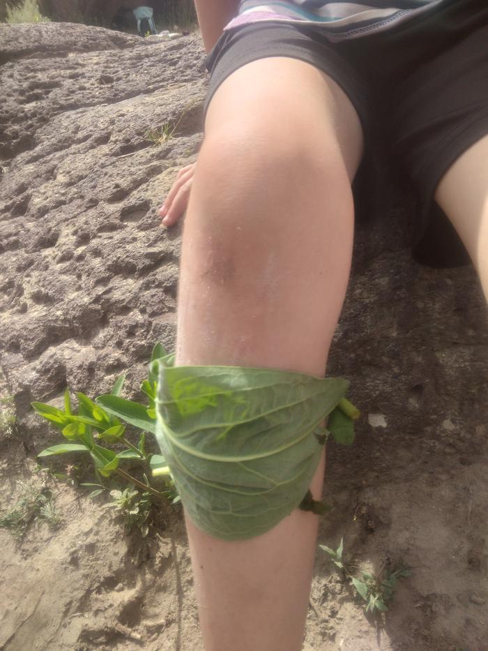 poultice applied