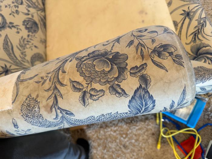 Up close on arm. It always gets so dirty.