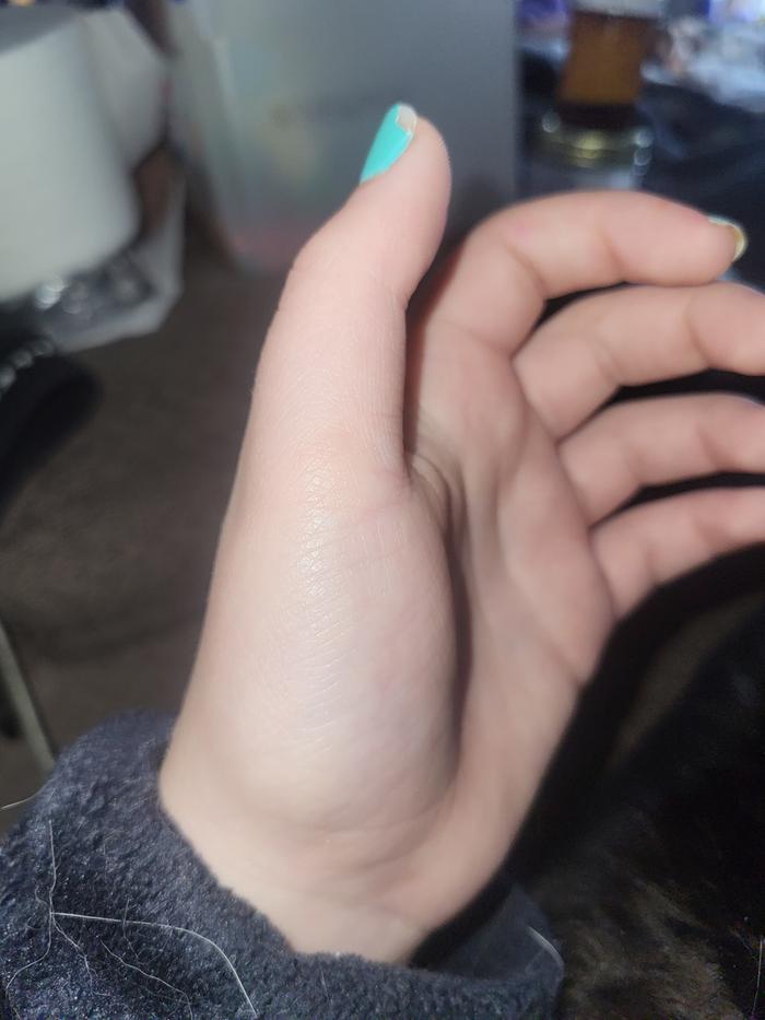 all healed 