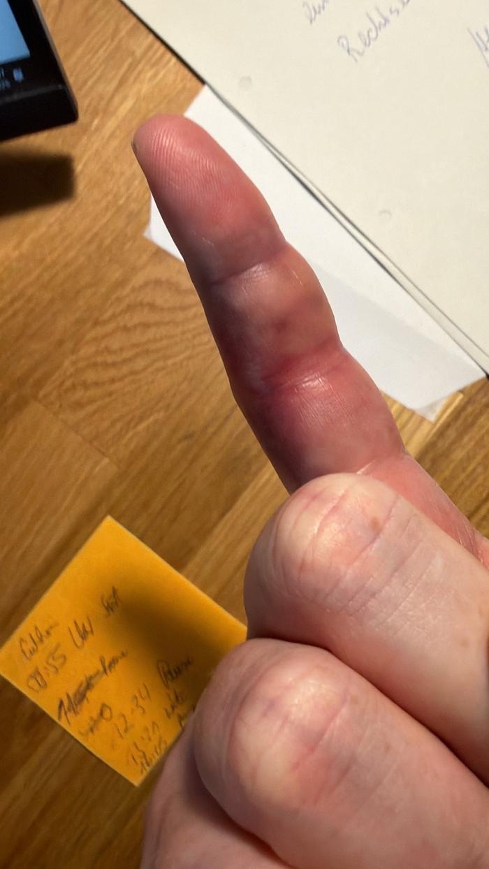 The finger.