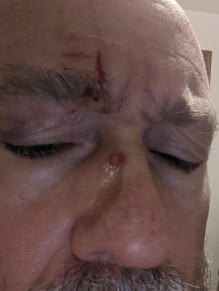 [Thumbnail for PXL_20251031_233411934.jpg]