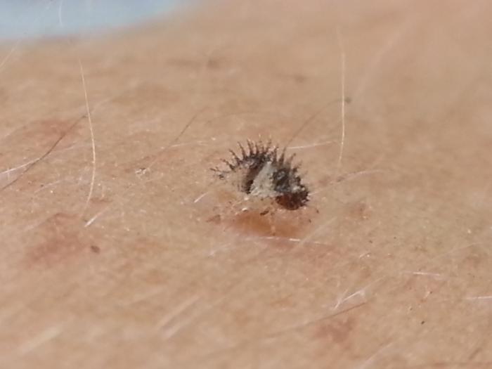 tiny lil hedgehog bug