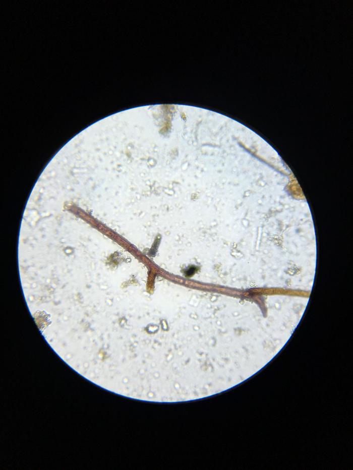 [Thumbnail for A-snapshot-of-a-fungal-hypha-taken-during-a-soil-microscopy-session..jpg]