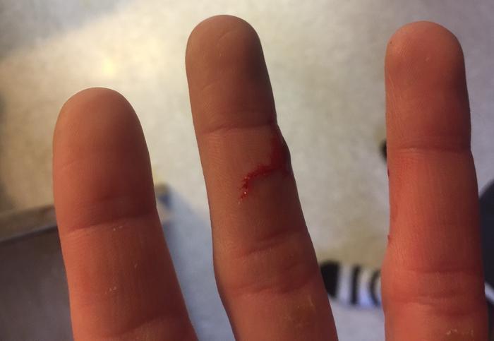 [Thumbnail for 11_cut_finger_00.jpg]